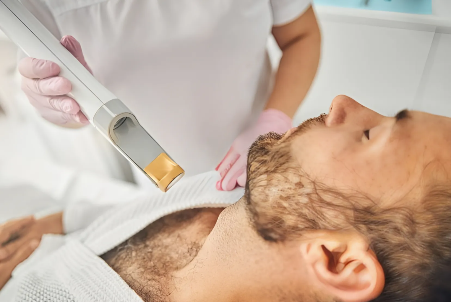 TRIỆT RÂU QUAI NÓN TOÀN BỘ - 10 buổi - 20 phút